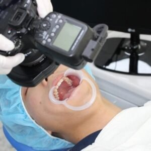 Photographie en dentisterie